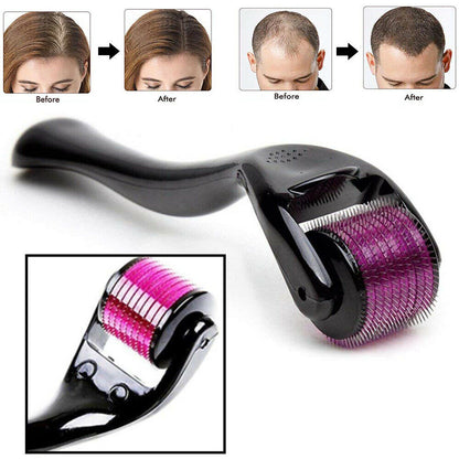 Skin Therapy 0.5 Derma Roller With 540 Micro Needle Roller for Men and Women & Unisex